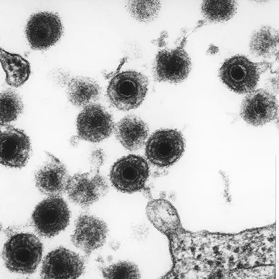 Human Herpes Virus 6 and Human Herpes Virus 7